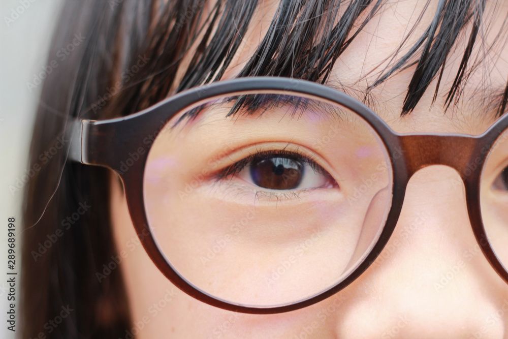 【画像】近視の女児